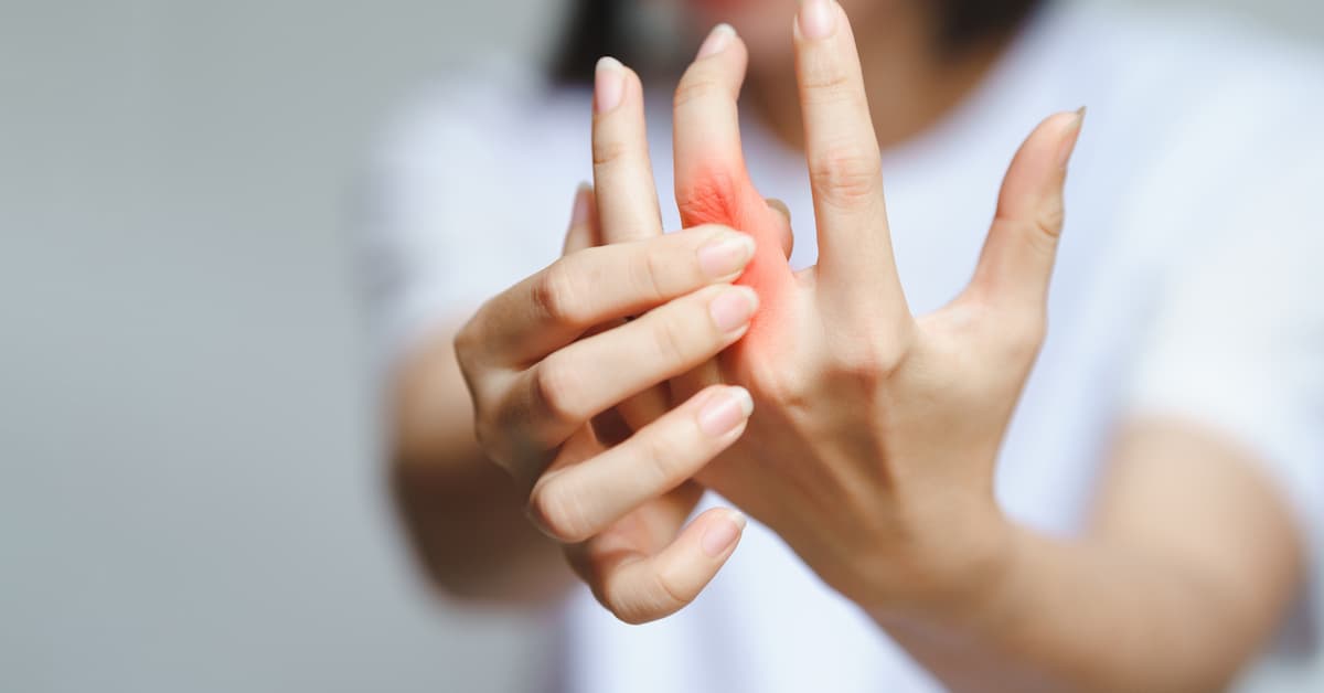 hand arthritis treatment boise
